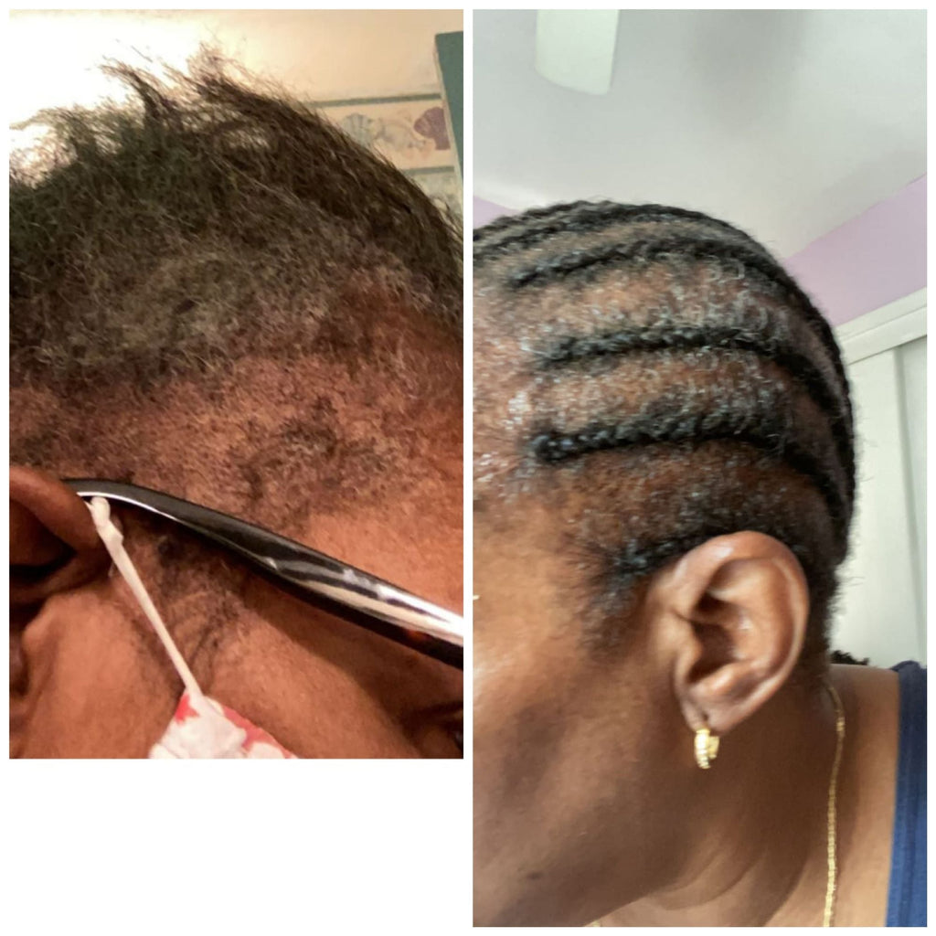 Pro Growth-Alopecia Anti-Thinning Hair Growth- With Haitian Vetiver-Jojoba Seed-Biotin- Argan-Peppermint Oil, Tea Tree Oil, Argan oil-P