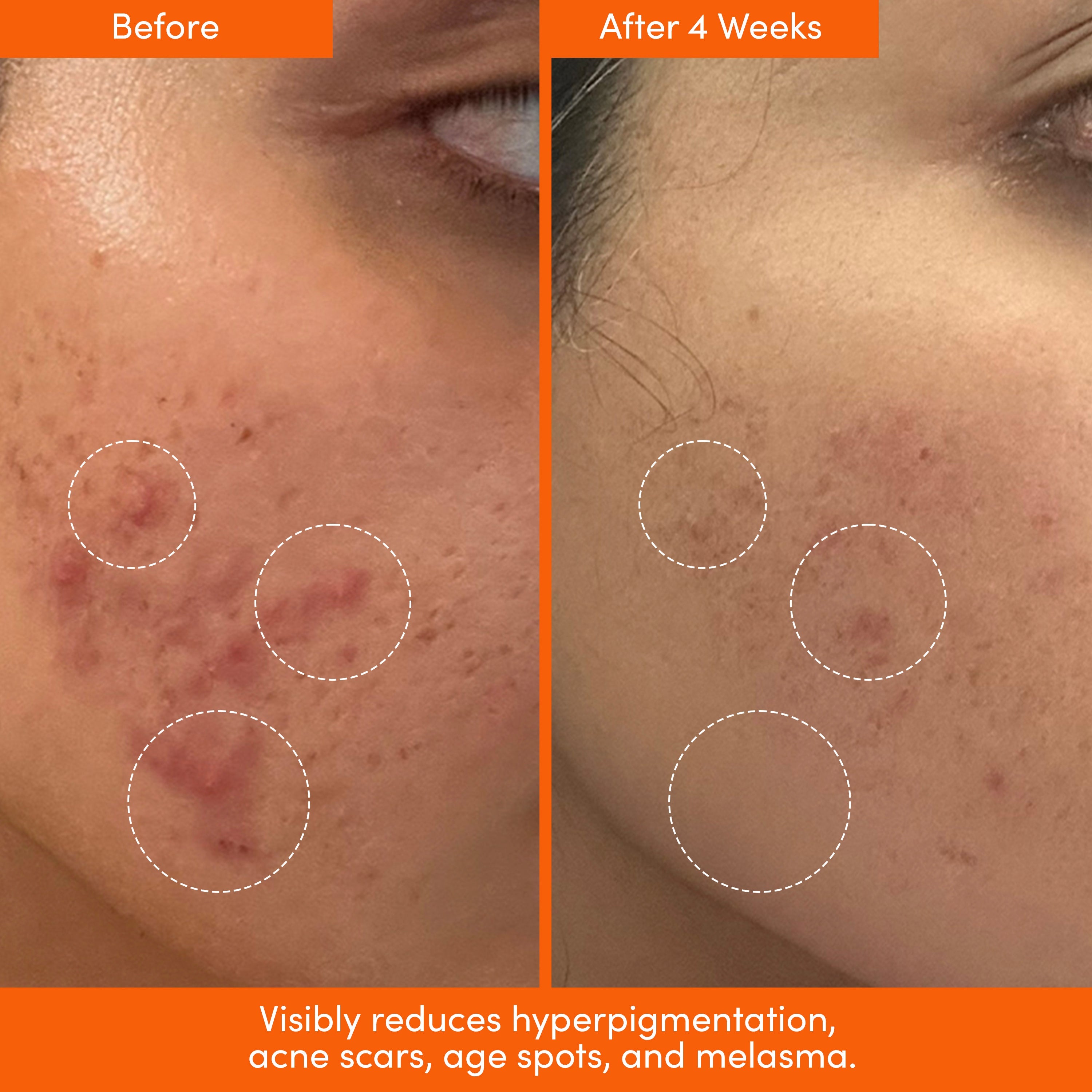 UNSPOTTED 4X® Acid Jelly Night Serum
