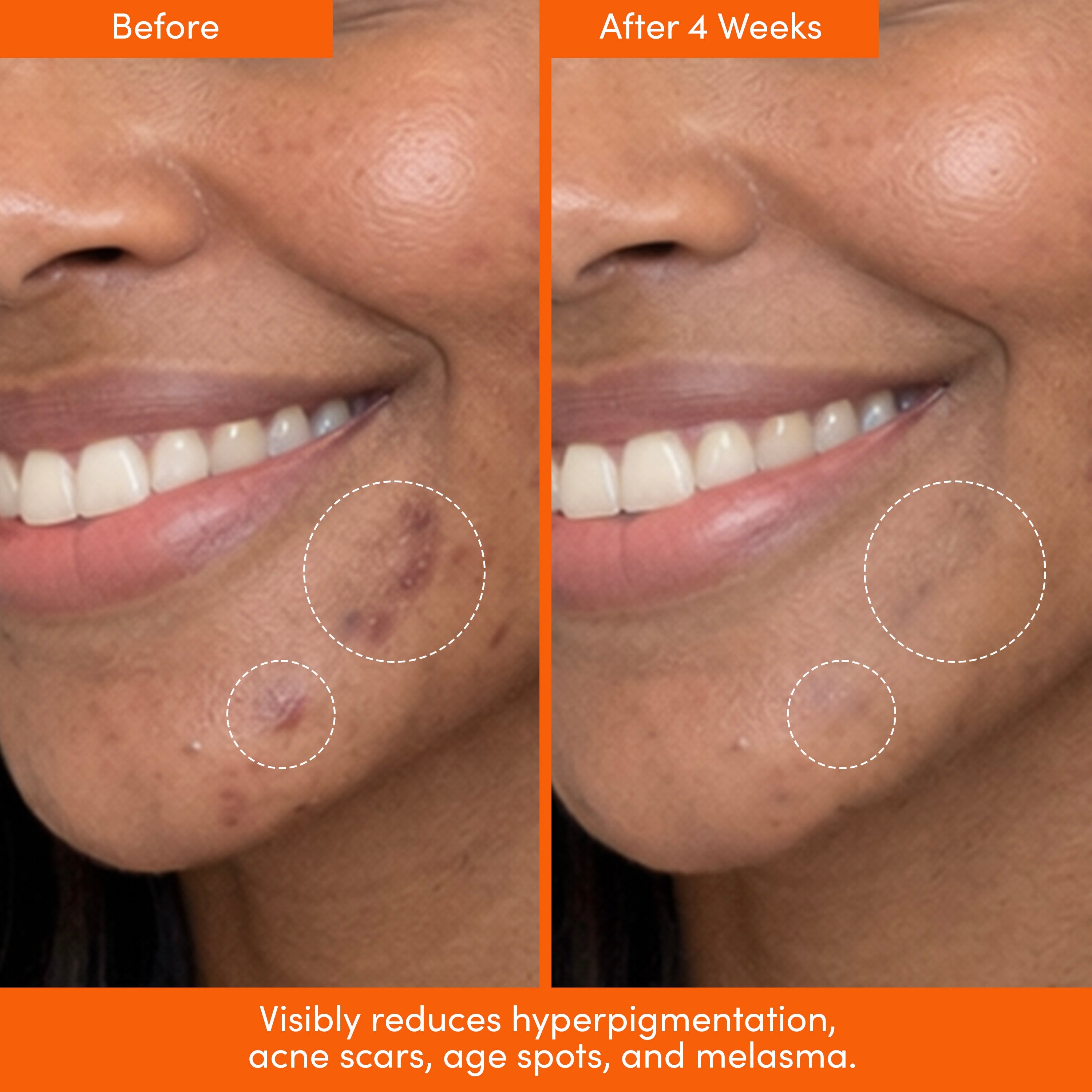 MANE SQUEEZE Tinted SPF + Dark Spot Serum Bundle
