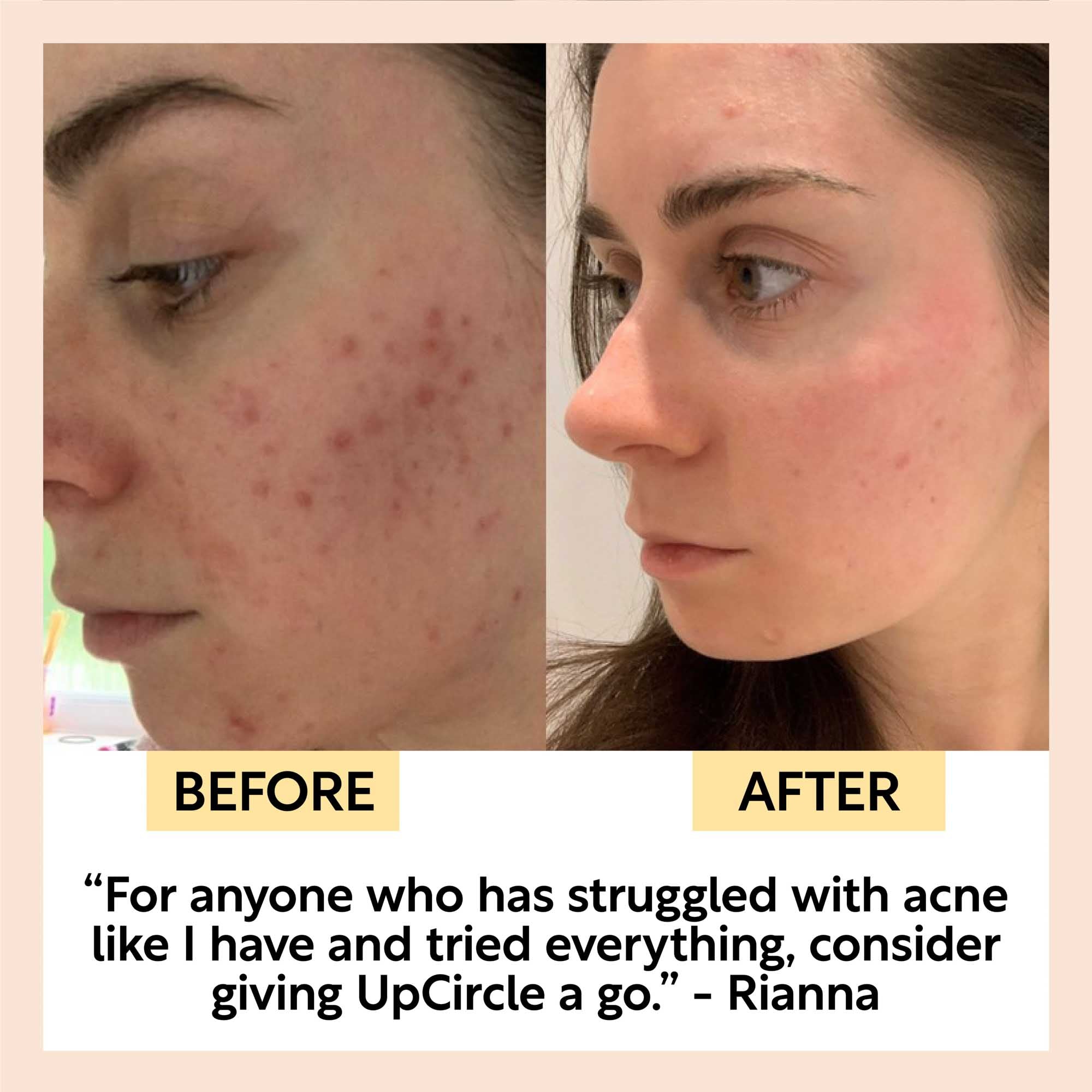 Face Toner with Hyaluronic Acid - Travel Size