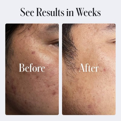 Geologie Clear System Skin Repair Moisturizer 0.2% Retinol 2 fl oz - Imperfect Box