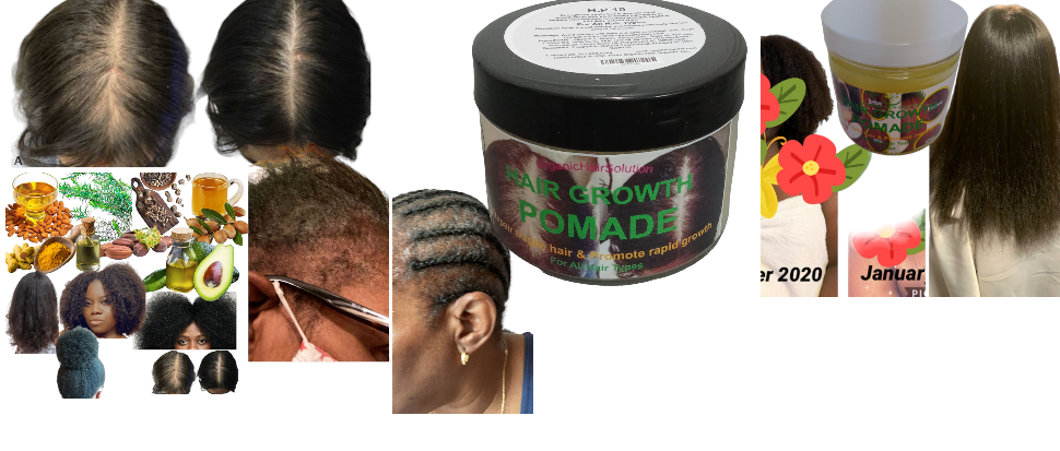 Hair Growth Pomade Grease with Mango butter, Peppermint Oil, Tea Tree Oil, Argan oil, Jojoba seed, Avocado oil, Castor oil, Sweet Almond, Vitamin E Oil for Scalp and Hair