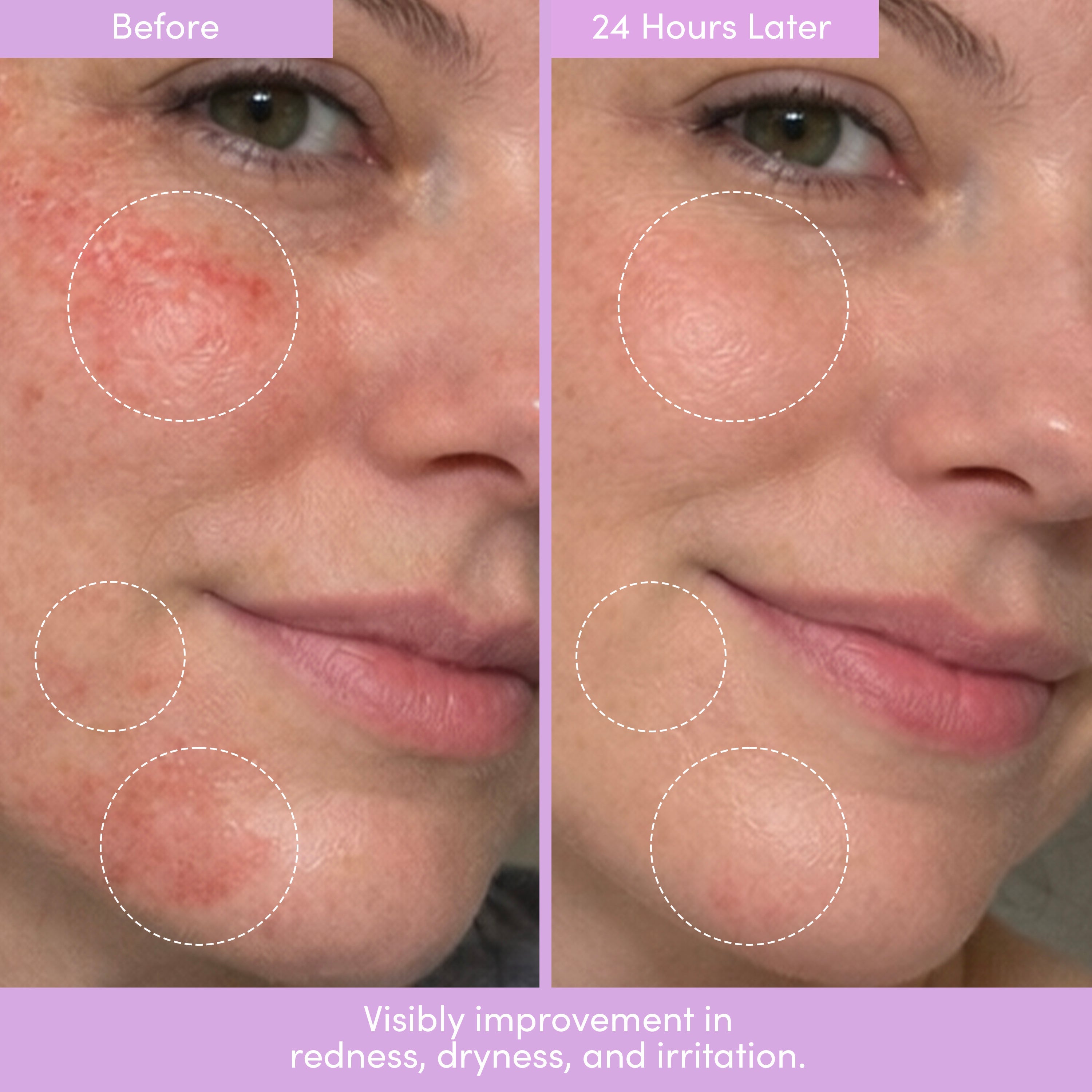 THIRST TRAP Barrier Repair Cream + SPF Ultra-Hydration Bundle