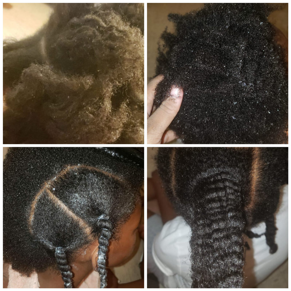 KIDS Hair Growth Set For All Hair Types With Jojoba seed-Mustard-Castor-Tea Tree-Argan-Avocado-Vitamin E (5 products),