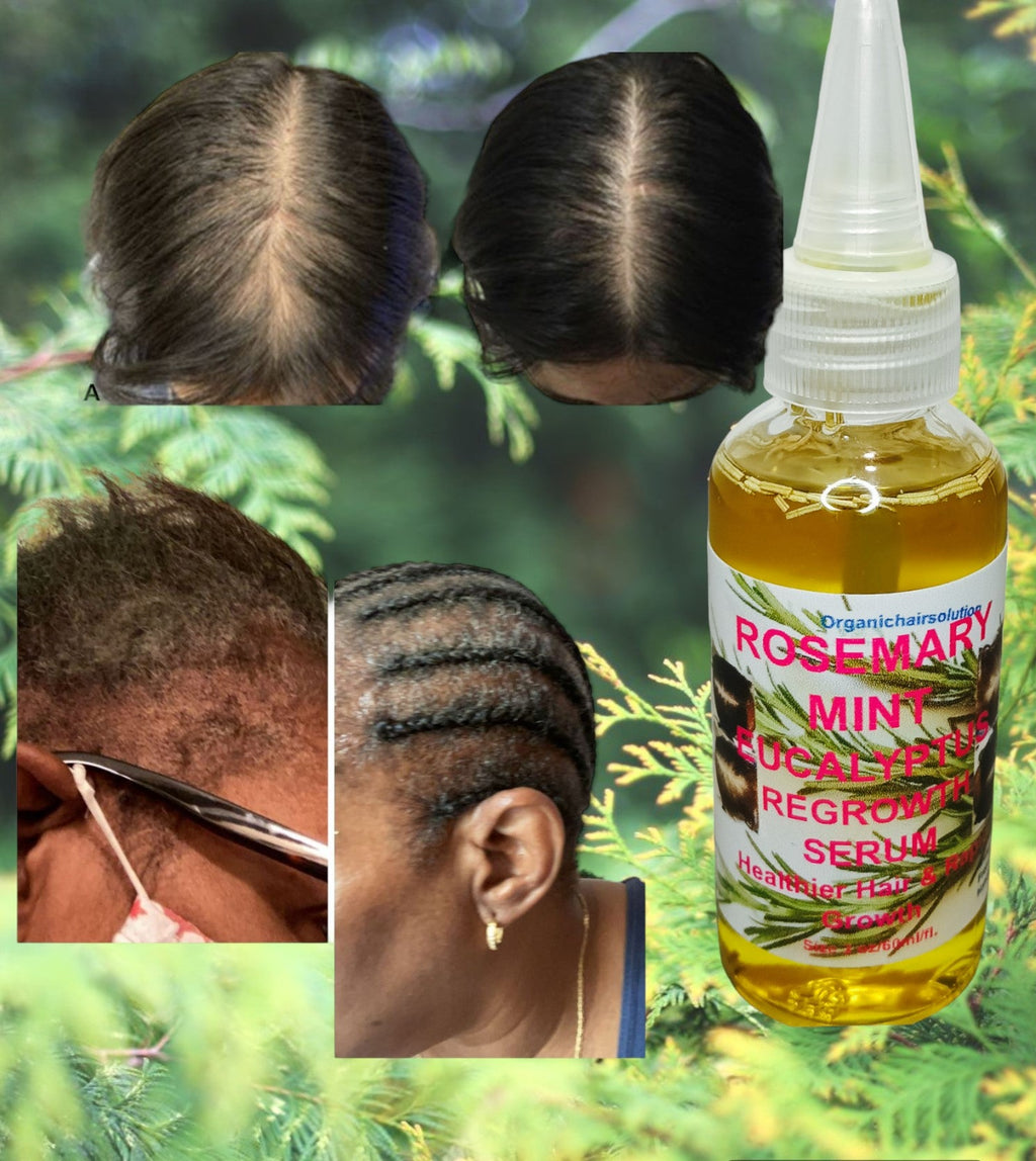 Rosemary Mint Scalp & Hair growth Oil With Biotin for Split Ends and Dry Scalp for All Hair Types, 2-Fluid Ounces