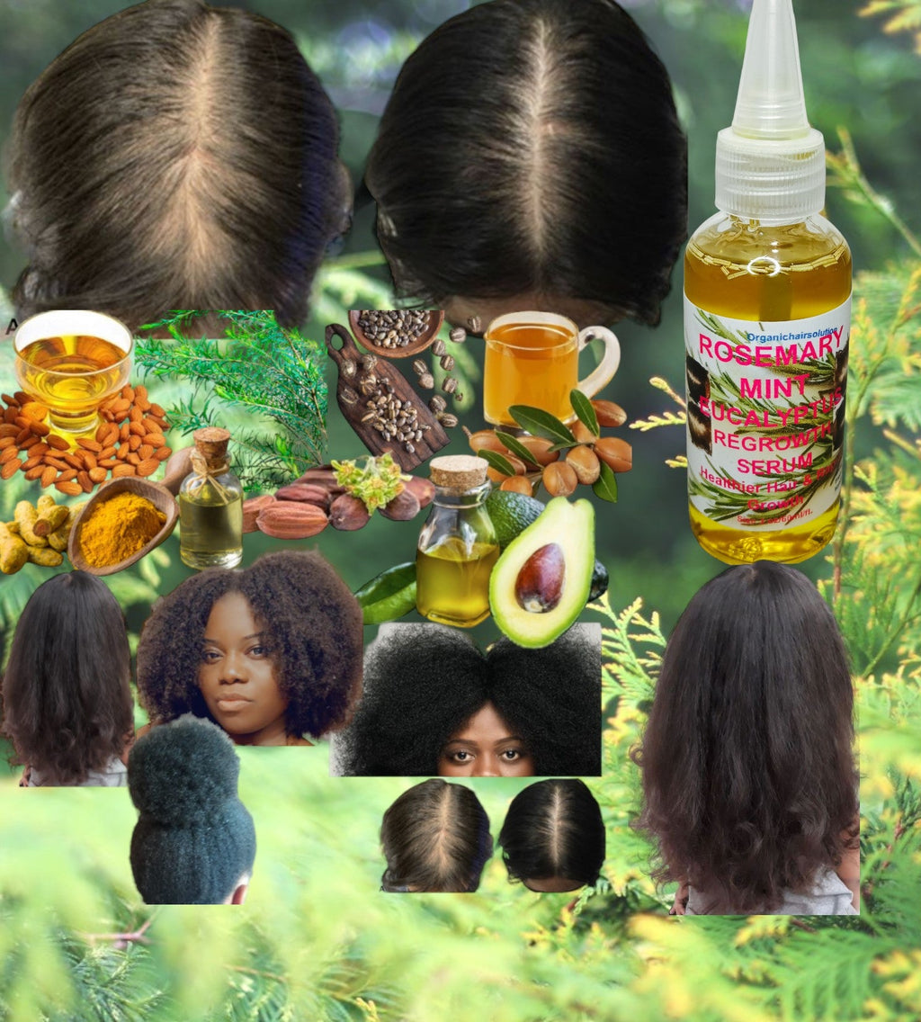 Rosemary Mint Scalp & Hair growth Oil With Biotin for Split Ends and Dry Scalp for All Hair Types, 2-Fluid Ounces