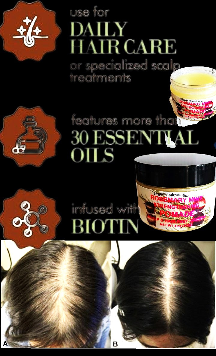 Organics Rosemary Mint Eucalyptus Hair Pomade, Grease/oil for Women, Men & Kids-Scalp & Hair